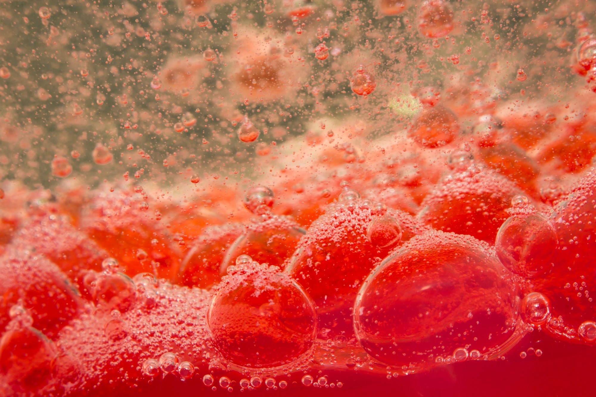 Study: Multimodal detection and analysis of microplastics in human thrombi from multiple anatomically distinct sites. Image Credit: Ezume Images / Shutterstock