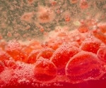 Study finds microplastics in blood clots, linking them to higher risk of heart attacks and strokes