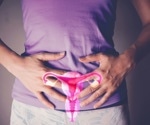 Clomiphene and dexamethasone boost fertility in PCOS patients