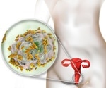 Study links diverse Gardnerella species in pregnant women to higher preterm birth risk