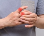 Study shows healthy plant-based diets lower gout risk, unhealthy diets raise it