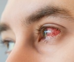 Evaluating the efficacy of harmol in treating herpes simplex virus-induced keratitis