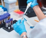 New strategy targets rare B cells for effective HIV vaccine development