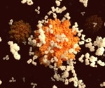 IgG from long COVID patients induces specific symptoms in mice, confirming autoimmunity's role