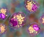 Genetic discovery reveals key to inflammatory diseases