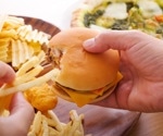 High-fat diet triggers anxiety in male rats through gut-brain axis disruption