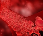 Proteins in blood may help to predict Parkinson’s disease up to seven years before the onset of motor symptoms