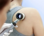 Melanoma messages: Social media a useful tool for skin cancer communication