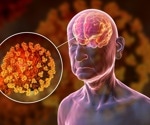 New study links COVID-19 to lasting neuropsychiatric issues, highlights vaccination benefits