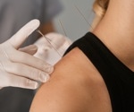 Efficacy of acupuncture in improving sleep quality for Parkinson's patients