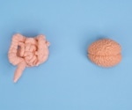 Associations between gut microbes and Alzheimer’s disease