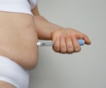 GLP-1-based polyagonists: A promising weight loss alternative to bariatric surgery