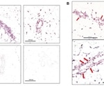 Genetic loss of miR-205 boosts mammary gland development in mice, reveals new insights into breast cancer suppression
