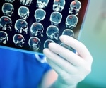 Rare but real: The neurological risks associated with vaccines