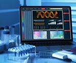 Study reveals genetic link between Alzheimer's disease, lipid metabolism, and coronary artery disease
