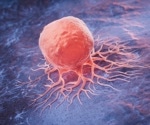 Fasting and ketogenic diet reveal new vulnerability of pancreatic tumors to existing cancer drug