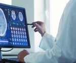 AI-driven adaptive deep brain stimulation improves Parkinson’s symptoms