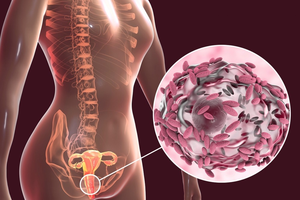 Study: Vaginal Lactobacillus fatty acid response mechanisms reveal a metabolite-targeted strategy for bacterial vaginosis treatment. Image Credit: Kateryna Kon/Shutterstock.com