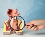 Total neoadjuvant therapy shows promising results in routine care for advanced rectal cancer