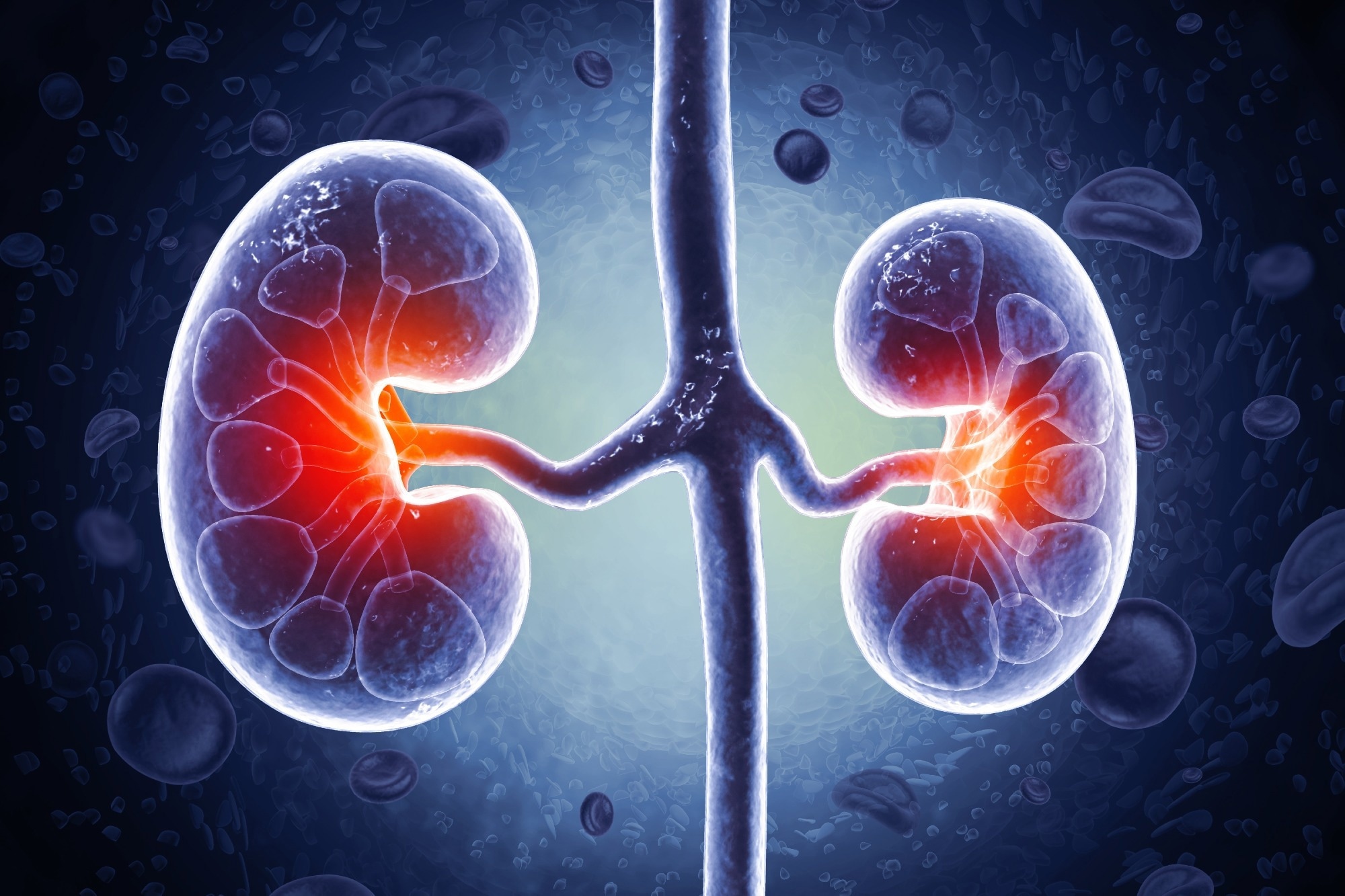 Study: Acute Kidney Injury and Its Association With Dementia and Specific Dementia Types: Findings From a Population-Based Study in Sweden. Image Credit: crystal light / Shutterstock.com