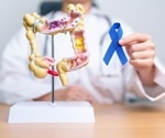 Lifestyle interventions in patients after colorectal cancer treatment
