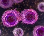 Researchers uncover why typically normal protein drives prostate cancer