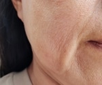 How nutrition and telomere dynamics shape beauty and aging in women