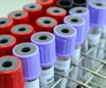 Revolutionizing disease prediction: MILTON framework utilizes biobank datasets to identify 3,213 diseases