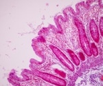 Dietary antigens reduce small intestine cancer by boosting immune T-cells