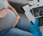 Maternal obesity doubles the risk of developing autism in children