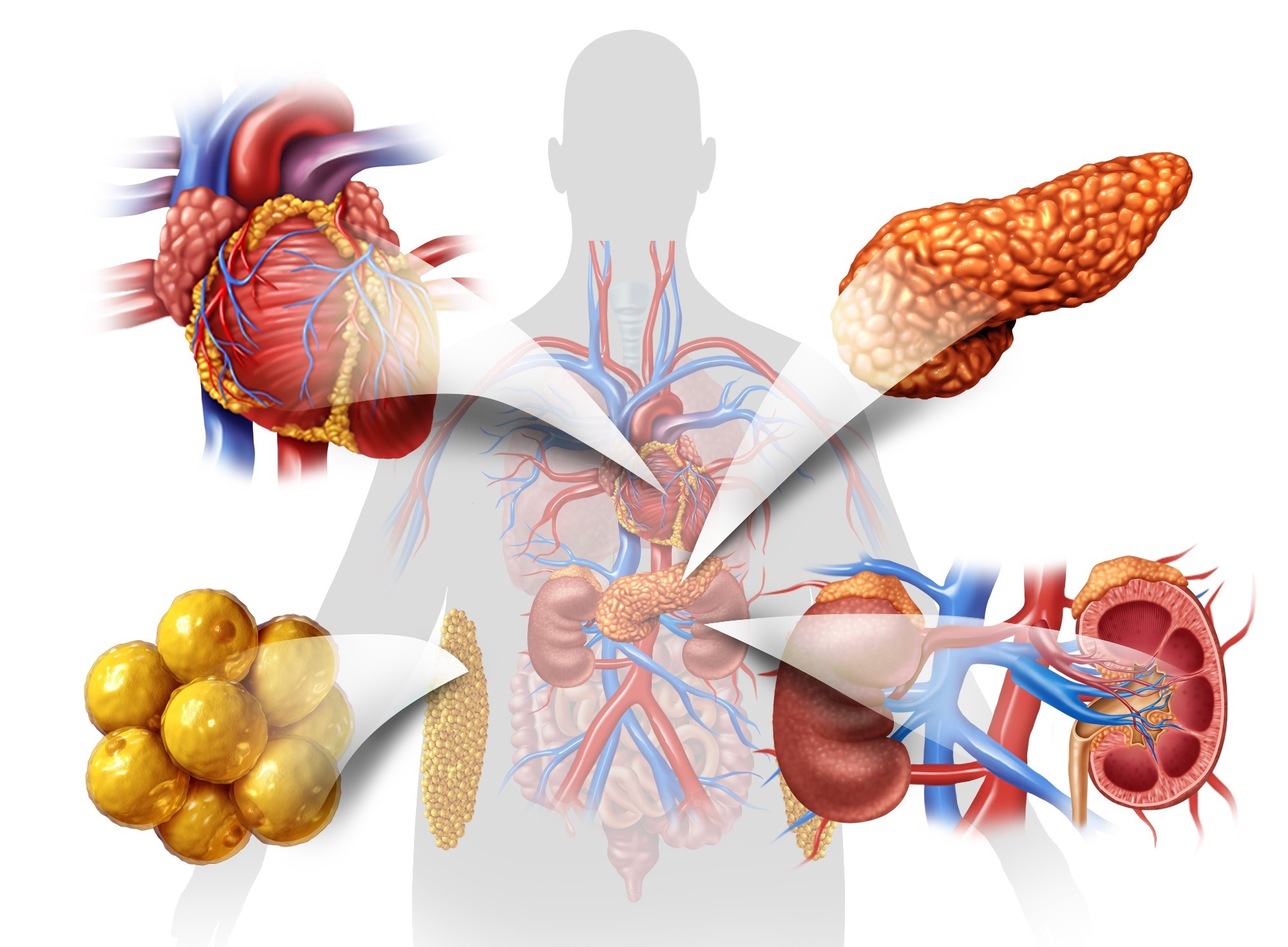 Study: Multivariate genomic analysis of 5 million people elucidates the genetic architecture of shared components of the metabolic syndrome. Image Credit: Lightspring / Shutterstock