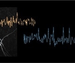 Bruker Introduces Innovative Neuroscience Research Solution with High-Speed OptoVolt Voltage Imaging