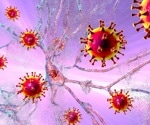 COVID-19 significantly raises stroke risk