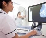 Breast cancer mortality plummets by 44%, but alarming racial gaps persist