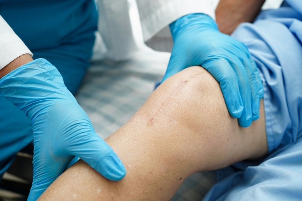 Study: A bioabsorbable mechanoelectric fiber as electrical stimulation suture. Image Credit: sweet_tomato/Shutterstock.com