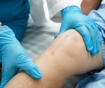 New surgical stitches capable of generating electrical charge may accelerate wound healing