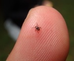 Study warns of increasing Rocky Mountain spotted fever cases among children in California