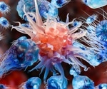 P-stalk ribosomes identified as key regulators of immune evasion in cancer