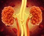 Semaglutide reduces urine albumin-to-creatinine ratio in overweight chronic kidney disease patients