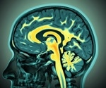 How calcium and magnesium deficiencies impact cognitive health
