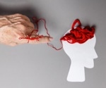 AI model predicts Alzheimer’s progression with new insights into racial and sex-based disparities