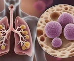 Berry-flavored vapes impair lung immune response