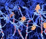 Spatial transcriptomics uncovers tissue niches in multiple sclerosis