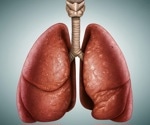 Vitamin D receptor activation slows cell overgrowth in pulmonary hypertension