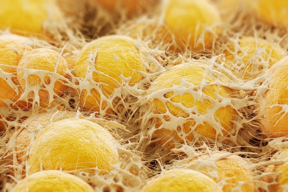 Study: Adipose tissue retains an epigenetic memory of obesity after weight loss. Image Credit: KateStudio/Shutterstock.com