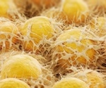 Memories of obesity can linger in fat cells long after weight loss