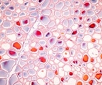 Mapping human biology: Human Cell Atlas leads a new era in precision medicine