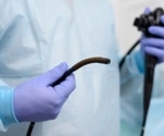 Capsule sponge test revolutionizes GERD diagnosis, reduces unnecessary endoscopies
