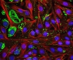 Spatial transcriptomics uncovers new treatment paths for triple-negative breast cancer