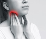 Study links early-life tonsil removal to long-term risk of stress-related disorders